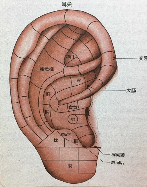 耳針図③ - コピー.jpg